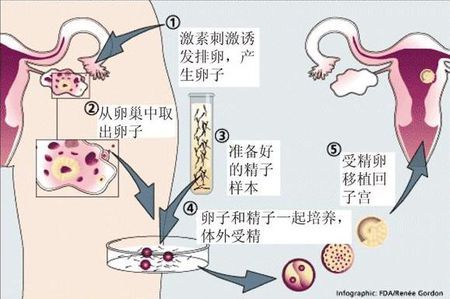 全球医疗